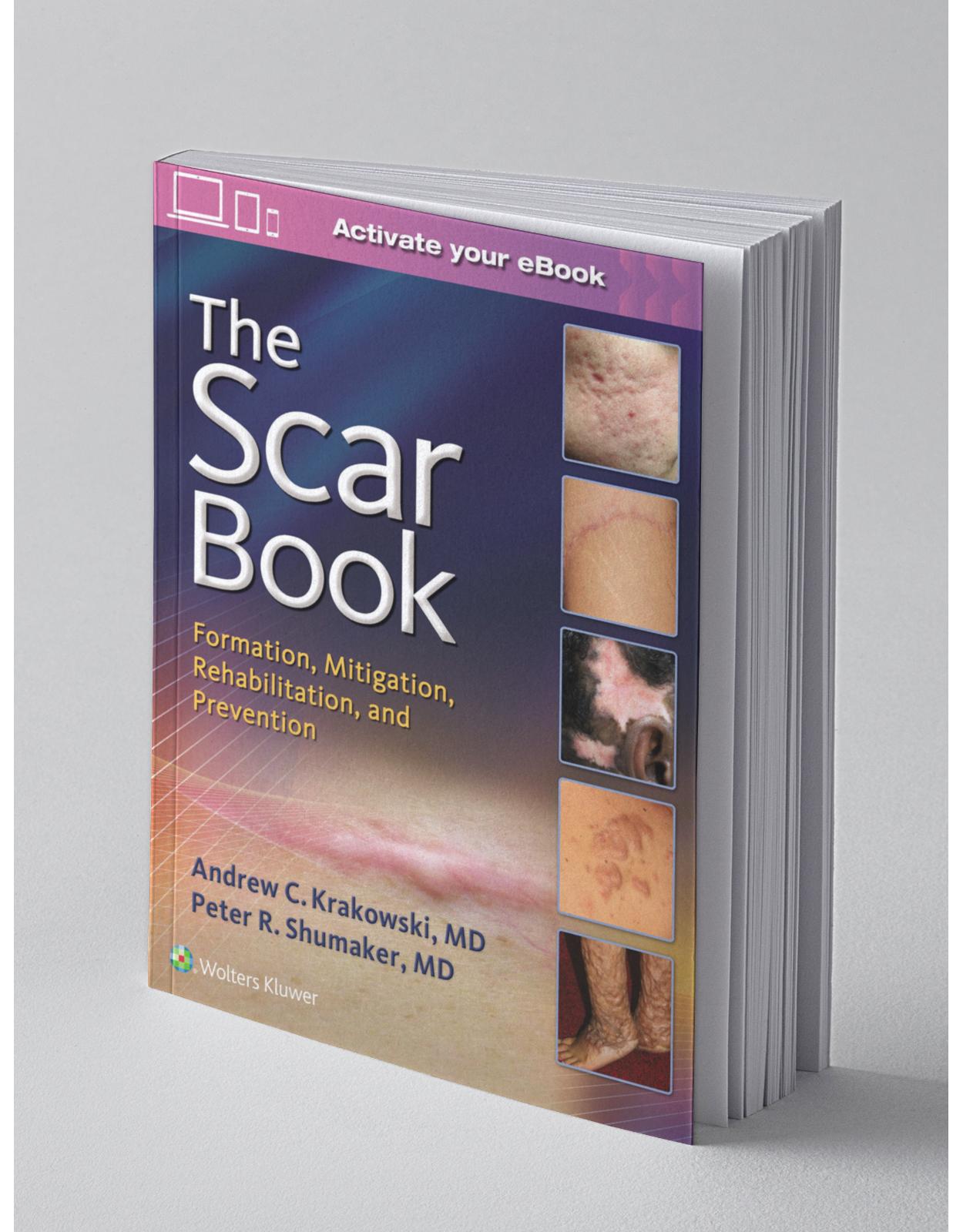 The Scar Book: Formation, Mitigation, Rehabilitation and Prevention