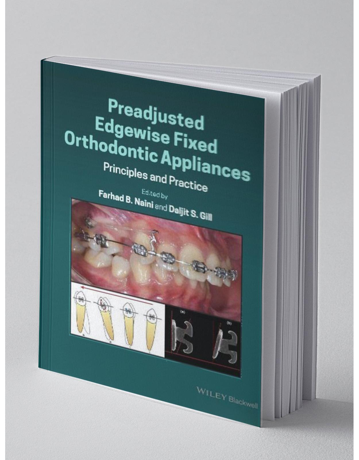 Preadjusted Edgewise Fixed Orthodontic Appliances: Principles and Practice