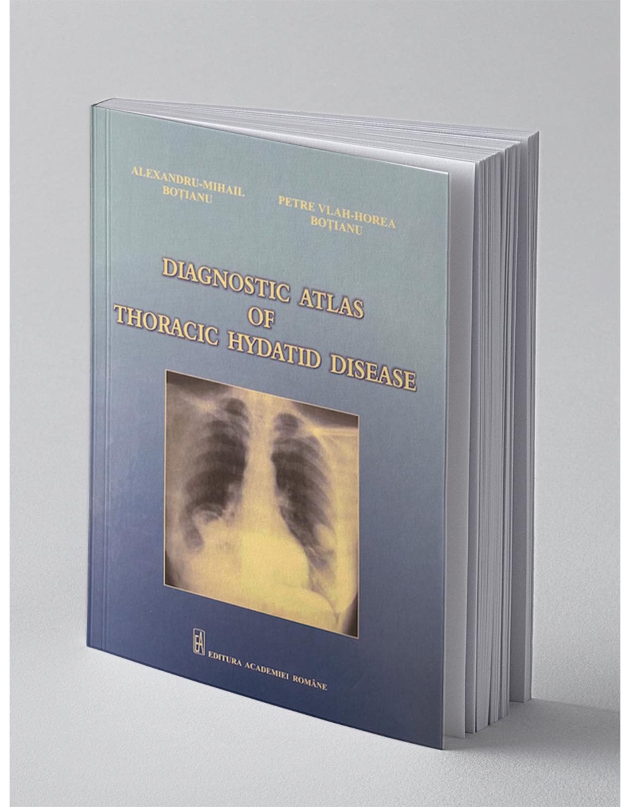 Diagnostic atlas of thoracic hydatid disease