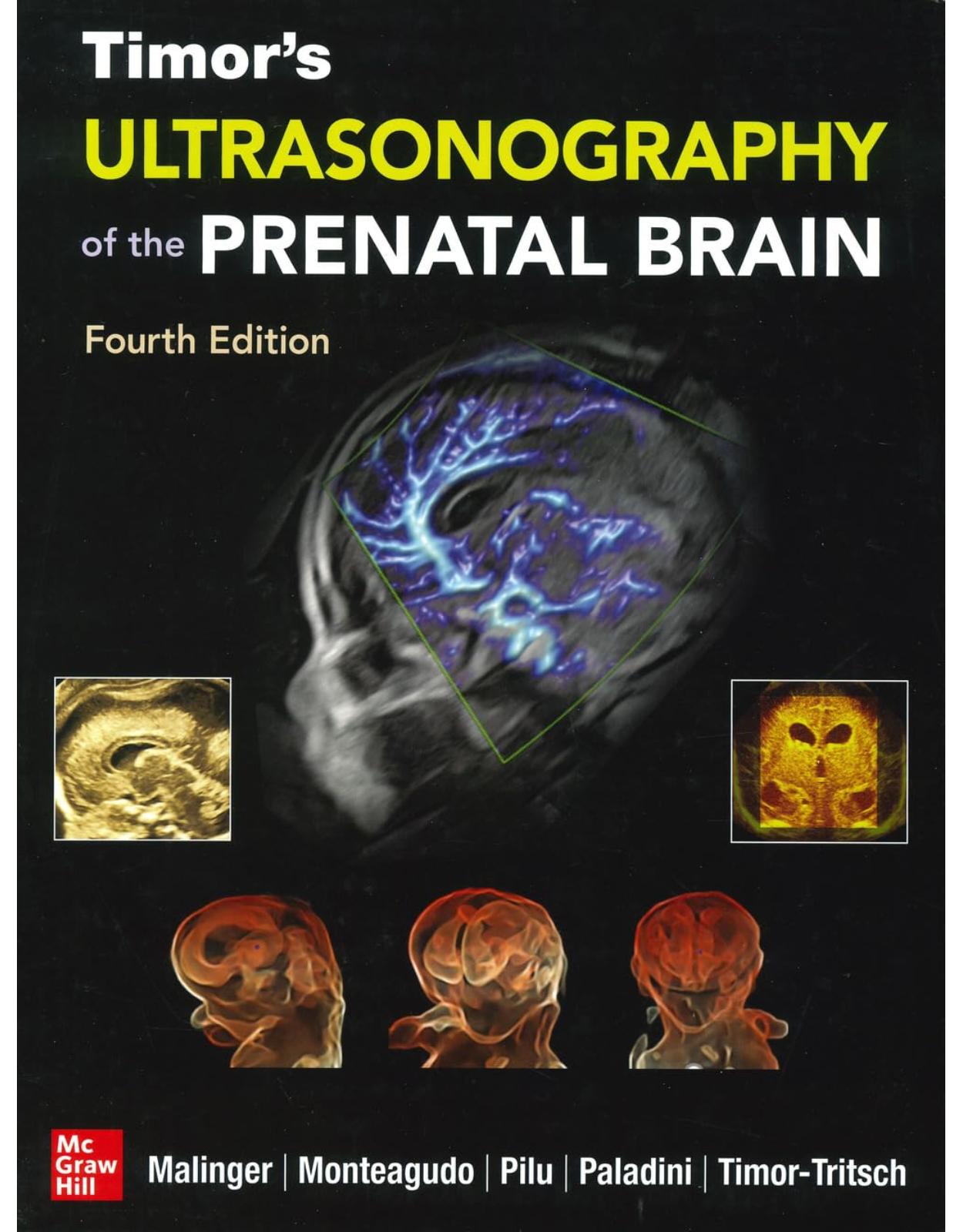 Timors Ultrasonography of the Prenatal Brain, Fourth Edition