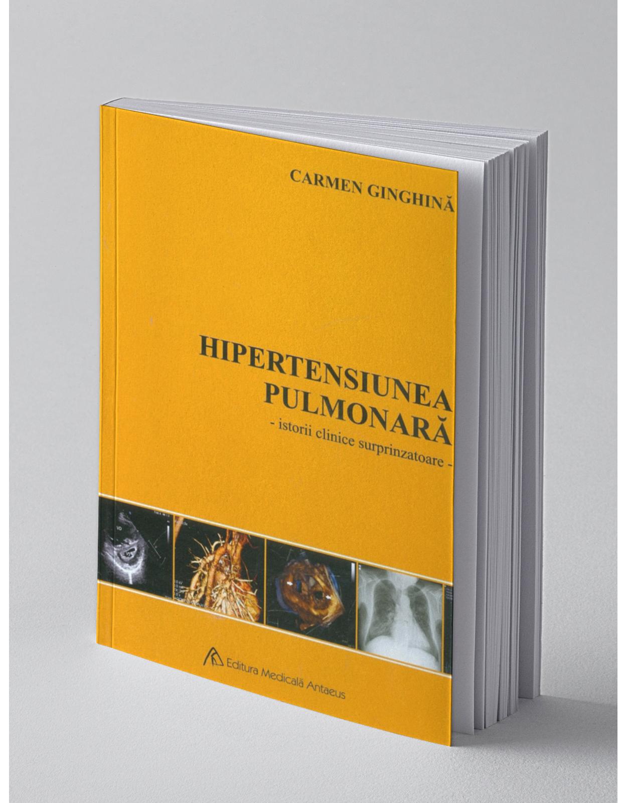 Hipertensiunea pulmonară - Istorii clinice surprinzatoare