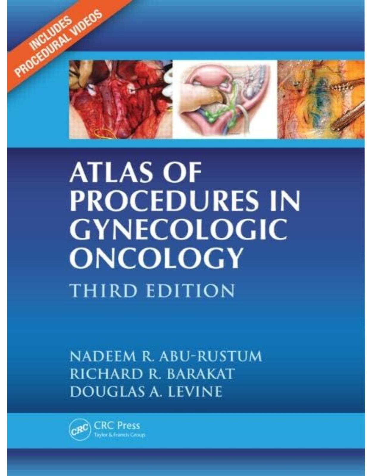 Atlas of Procedures in Gynecologic Oncology, Third Edition